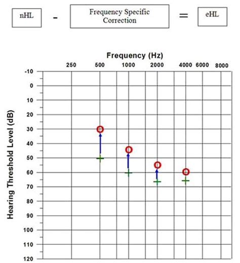 Using ABR Thresholds in Pediatric Hearing Aid Fittings. .